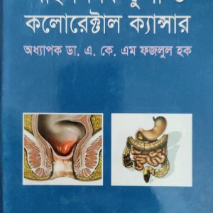 পাইলস ফিস্টুলা ও কলোরেক্টাল ক্যান্সার