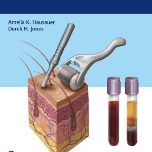 PRP and Microneedling in Aesthetic Medicine